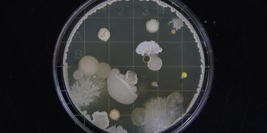 bakterie, tma, mikroskop, pod lupou