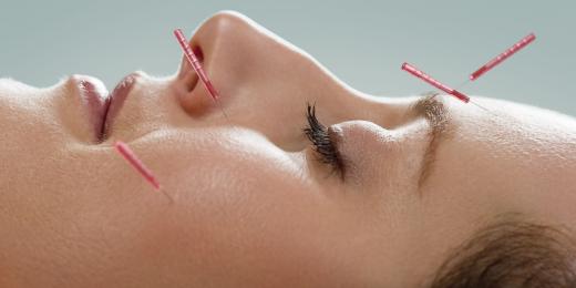 Akupresura a akupunktura