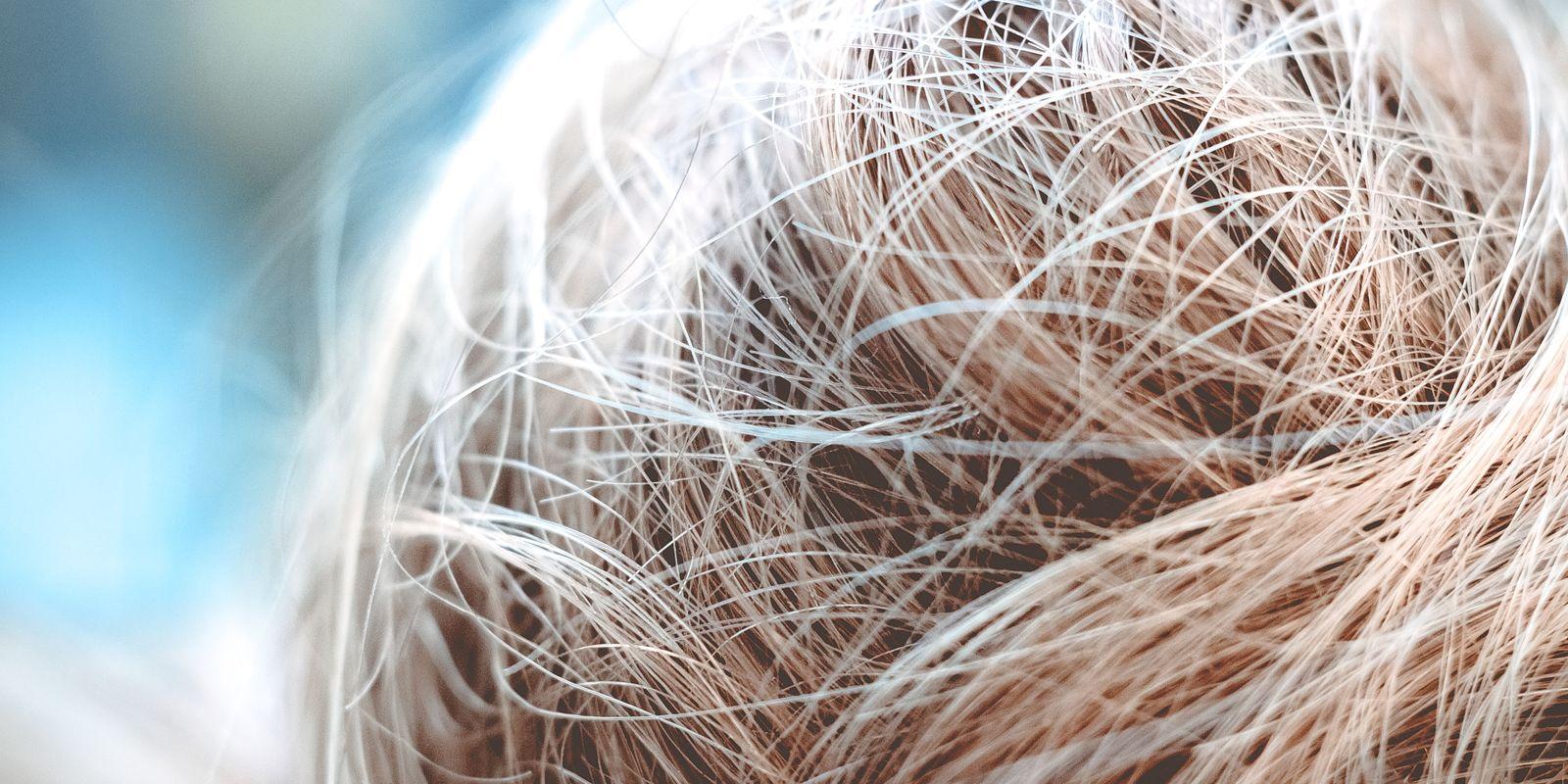 Jaké další faktory ovlivňují zdravé vlasy a eliminují jejich padání?