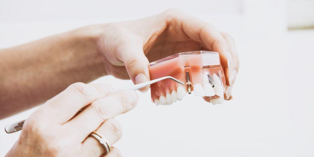 Zuby jsou odrazem našeho způsobu života